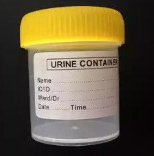 OEM médico feito sob encomenda do molde do coletor da urina da modelagem por injeção do CAD/UG